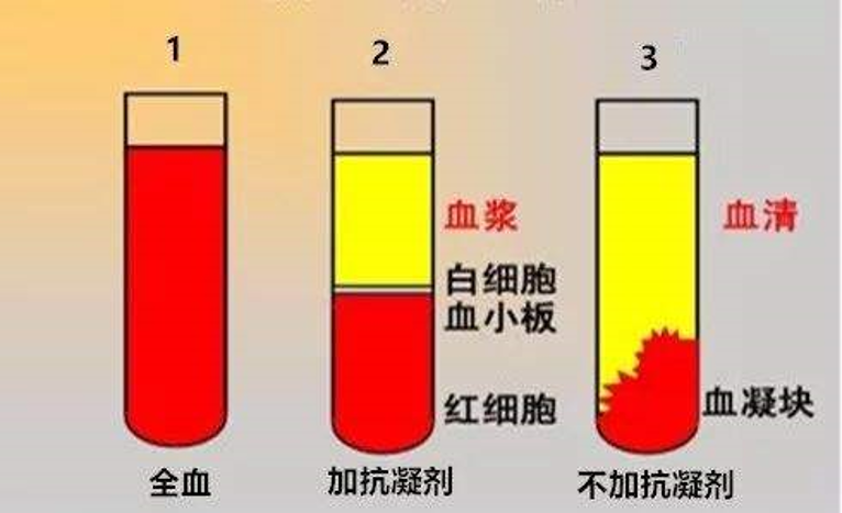 正常情況下-正常情況下血漿什么顏色
